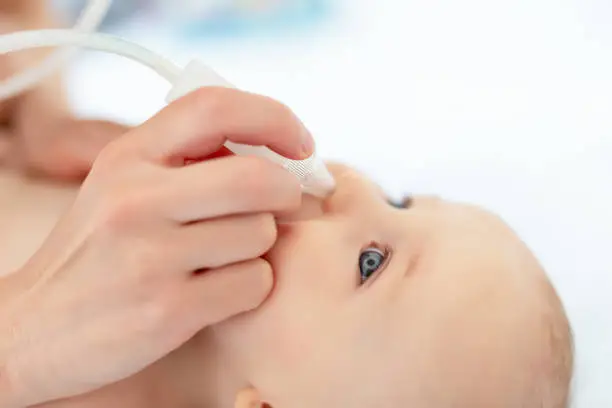 Closeup mother hand with aspirator medical tool cleaning runny nose of cute infant newborn baby boy son at home indoors. Baby parent health care and love concept.