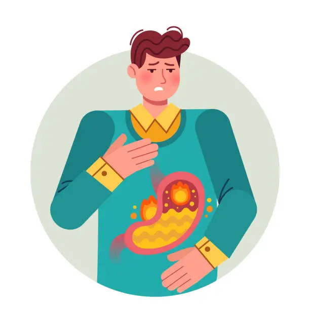 Vector illustration of Heartburn. Gastric disease, stomach problem. Bloating abdomen gastroesophageal reflux or high acidity esophagus, flat vector illustration.