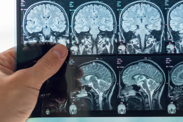 o médico analisa uma imagem de ressonância magnética do cérebro - mri scan human nervous system brain medical scan - fotografias e filmes do acervo