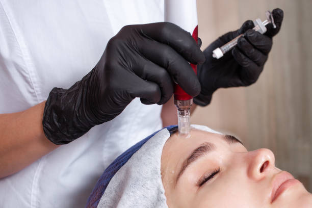 istock The beautician performs the procedure micronidling, dermopen 1254101755