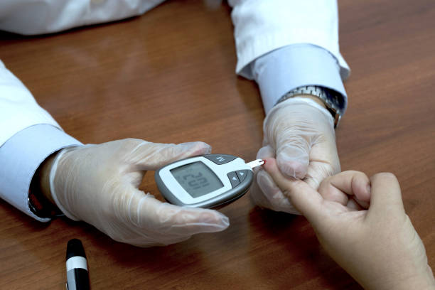 환자의 혈당을 확인하기 위해 손가락 혈액 검사를하는 의사. 포도당 검사 - diabetes high up blood sugar test glucose 뉴스 사진 이미지