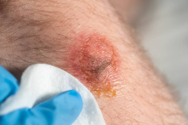 istock first aid for a man who have had a motorbike accident 1254209075