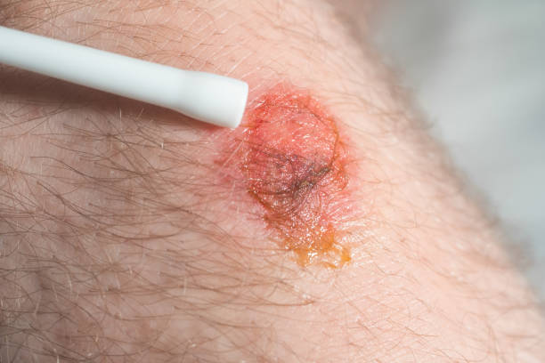 istock first aid for a man who have had a motorbike accident 1254209089