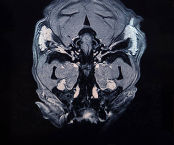 ressonância magnética do crânio do cão - neuroscience mri scan brain brain surgery - fotografias e filmes do acervo