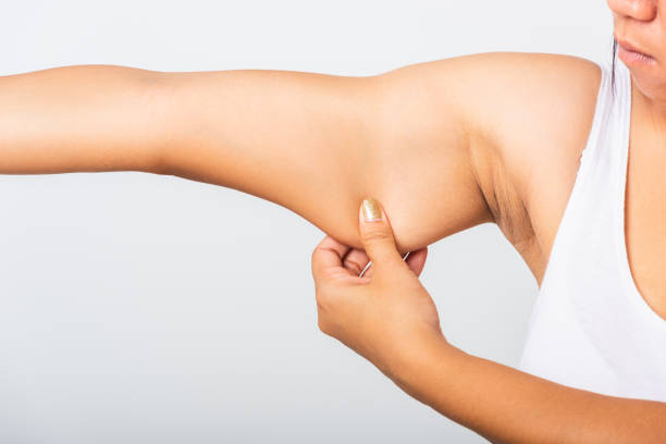 istock Close up of Asian woman pulling excess fat on her under arm, problem armpit skin, studio isolated on white background, Healthy overweight excess body concept 1254306986