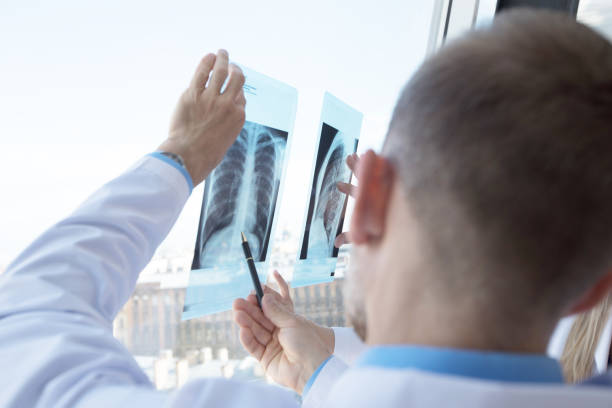 istock Doctors examining x-ray film 1254345673