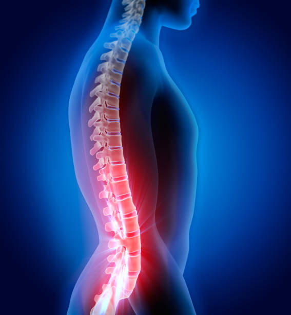 인간 남성 척추 - 3d 일러스트 - human spine backache pain back 뉴스 사진 이미지