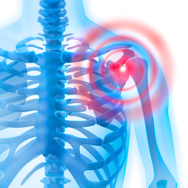istock 3D Illustration of painful shoulder 1254390449