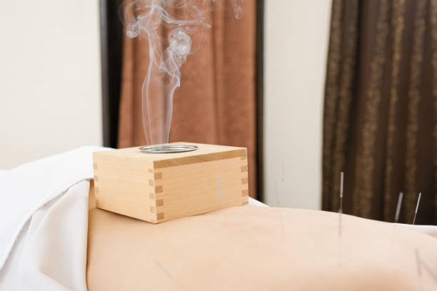 moxibustion caixa colocado na cintura de uma mulher em um centro de acupuntura brilhante - massaging relaxation indoors traditional culture - fotografias e filmes do acervo