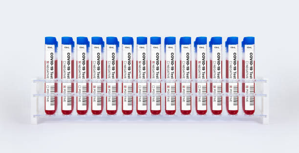 istock COVID-19 Corona Virus Test Tube Rack 1254501176