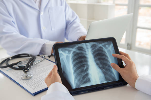 medico radiografia - human lung asthmatic x ray human internal organ foto e immagini stock
