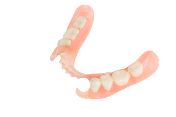 Removable plastic partial denture Removable plastic partial denture on white background prosthetic equipment photos stock pictures, royalty-free photos & images