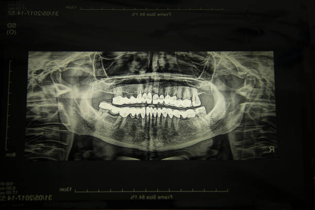 白い背景にレントゲンを持つ歯科医。 - 歯 写真 ストックフォトと画像