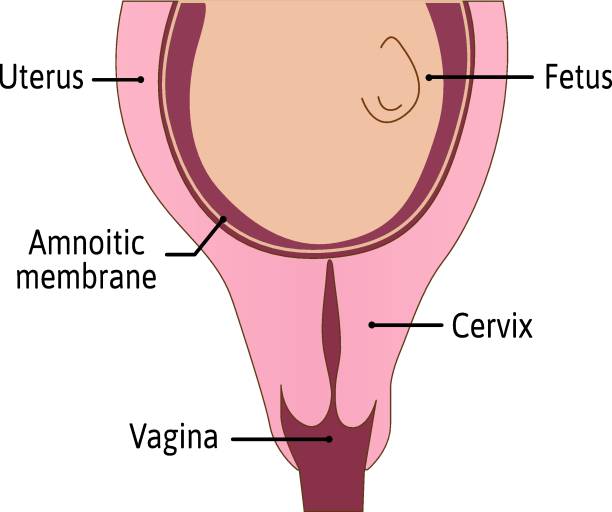 Cervix is not effaced. First stage of delivery process. cervix is tightly closed and protected. Uterus with baby or fetus inside. Medical vector illustration isolated on white Cervix is not effaced. First stage of delivery process. cervix is tightly closed and protected. Uterus with baby or fetus inside. Medical vector illustration isolated on white. dilation stock illustrations