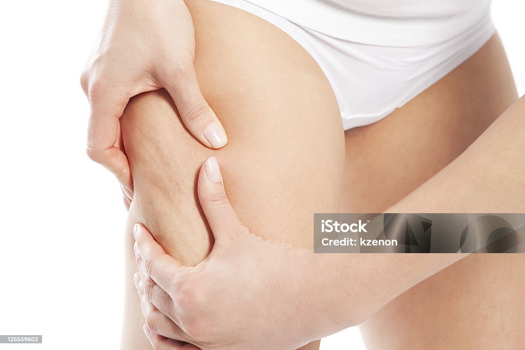 Cellulite – body and beauty Cellulite - woman testing her skin for issues Cellulite Stock Photo