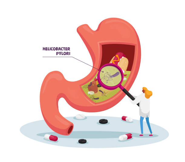 ilustraciones, imágenes clip art, dibujos animados e iconos de stock de tiny doctor carácter con enorme lupa aprendizaje de estómago enfermo con enfermedad de helicobacter pylori o gastritis. concepto de medicina y salud de la gastroenterología. ilustración de vectores de dibujos animados - pylori