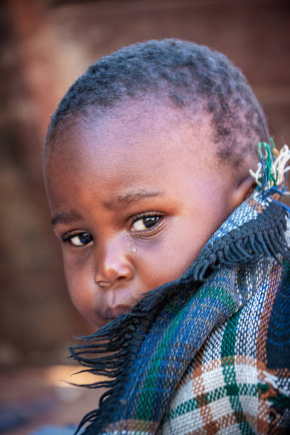 istock african child toddler sick with malaria 1255857461