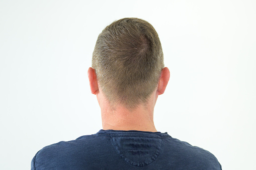 Rear view of the head of a middle-aged man with short hair wearing a casual blue shirt over a white wall background