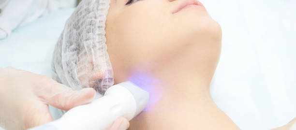 dermatologie soins de la peau thérapie faciale. procédure médicale de rides d’anto de spa. rajeunissement de visage de femme. jolie fille. rf équipement cosmétique. menton et cou - head massage audio photos et images de collection