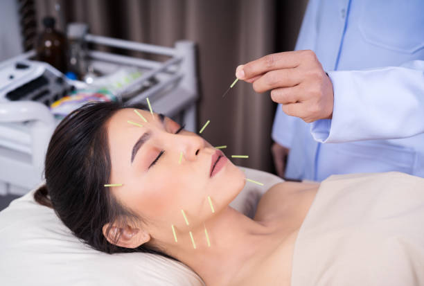 istock woman undergoing acupuncture treatment on face 1255920542