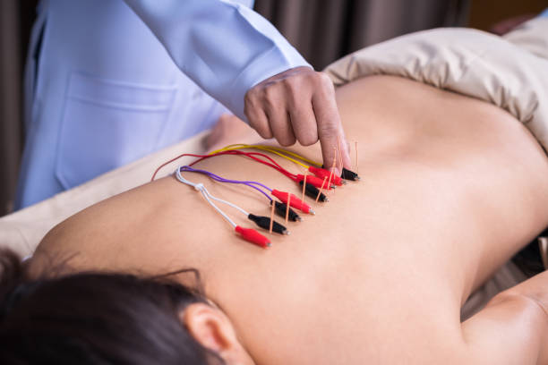 istock woman undergoing acupuncture treatment with electrical stimulator on back 1255920550