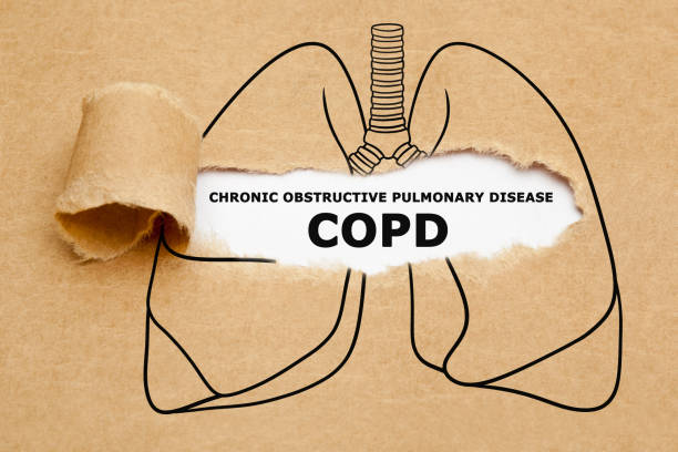 Chronic Obstructive Pulmonary Disease COPD Concept Text Chronic Obstructive Pulmonary Disease COPD appearing behind torn brown paper in human lungs drawing. cardio pulmonary stock pictures, royalty-free photos & images