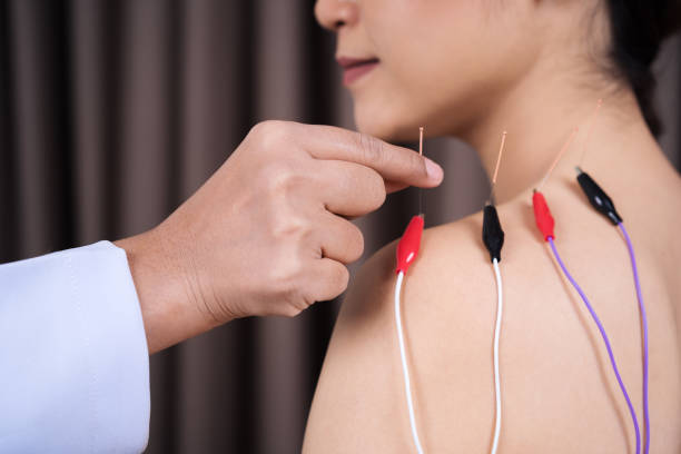 istock woman undergoing acupuncture treatment with electrical stimulator on shoulder 1256020482