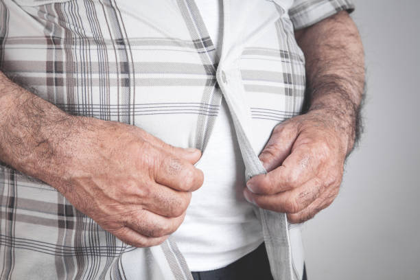 istock Fat man fastening buttons on shirt. 1256049325