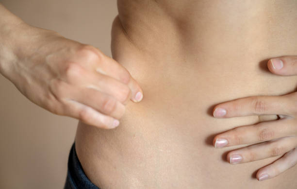 istock Young fit woman checking fat. 1256131565