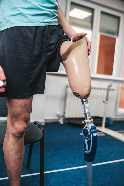 istock Disabled man at physiotherapy center 1256140374