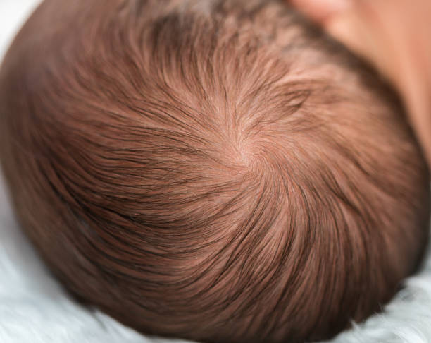 istock head of newborn baby 1256248383
