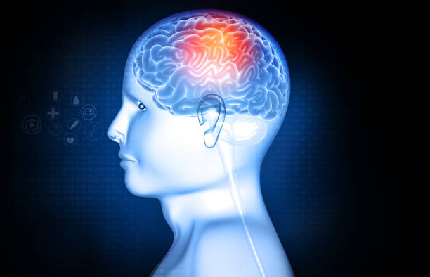 istock Human brain injury, damage,hemorrhage 1256259425
