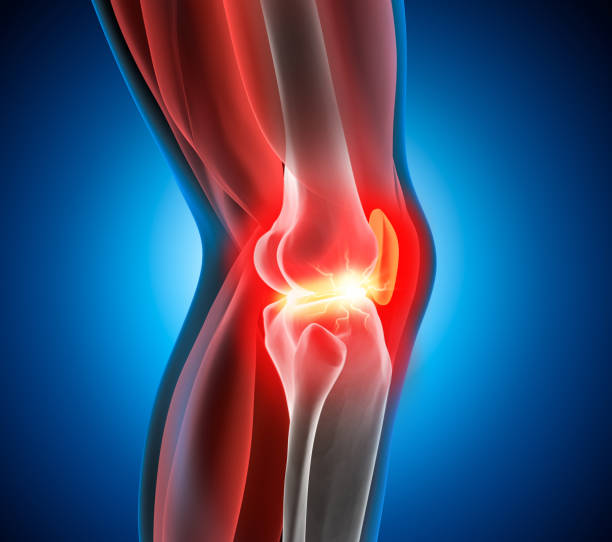 Painful Knee Knee with painsymptom - 3D Illustration medical concept osteoarthritis stock pictures, royalty-free photos & images
