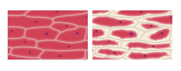 Plasmolysis in onion epidermis cells A single layer of plant cells is placed on a microscope slide and either distilled water or 5% sodium chloride solution is added to the cells. Osmosis will occur resulting in either turgid cells or plasmolysed cells epidermal cell stock illustrations