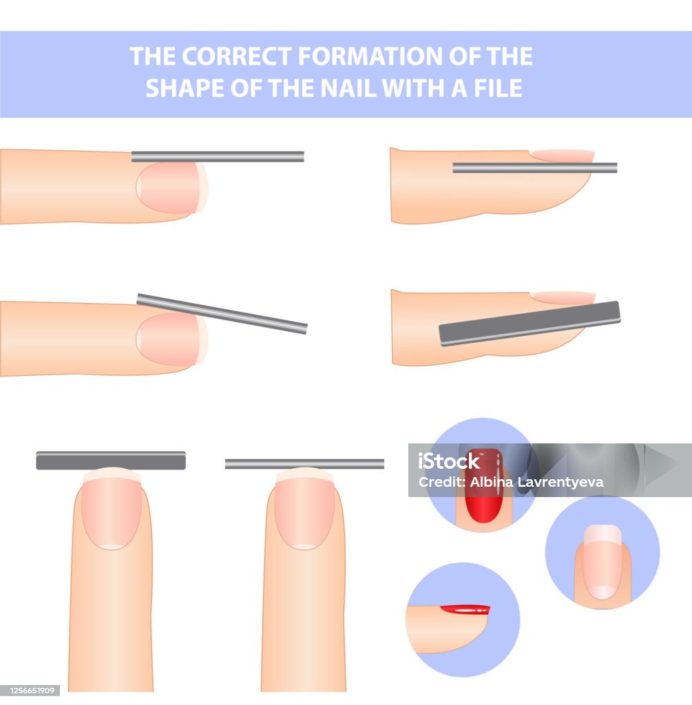 Textbook On The Formation Of Nails The Shape Of A Square Nail Stock  Illustration - Download Image Now - iStock