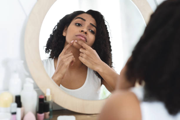 Skin Blemishes. Sad Black Woman Trying To Remove Pimple From Chin Skin Blemishes. Sad Black Woman Trying To Remove Pimple From Chin, Standing In Front Of Mirror At Home, Selective Focus looking in mirror stock pictures, royalty-free photos & images