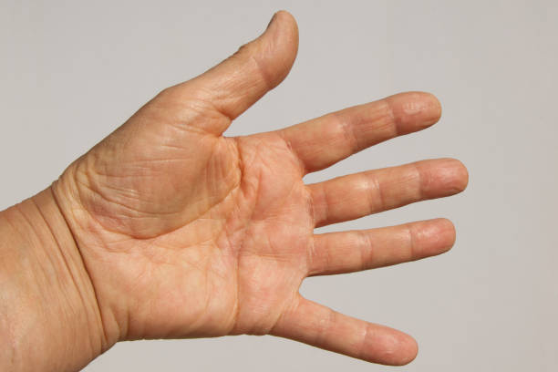 istock Male hand palm 1256691150