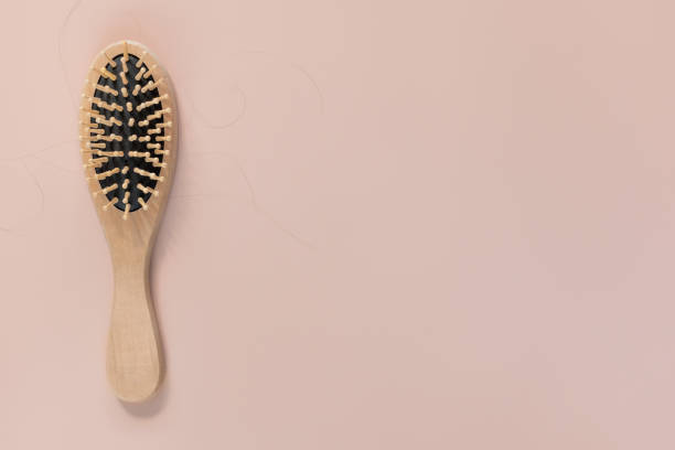 istock Hair loss concept. 1256854307