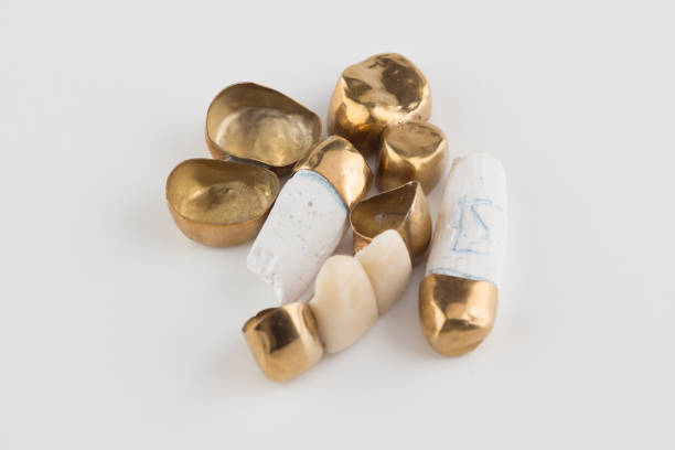 istock stamped brazed dental bridges 1256895799