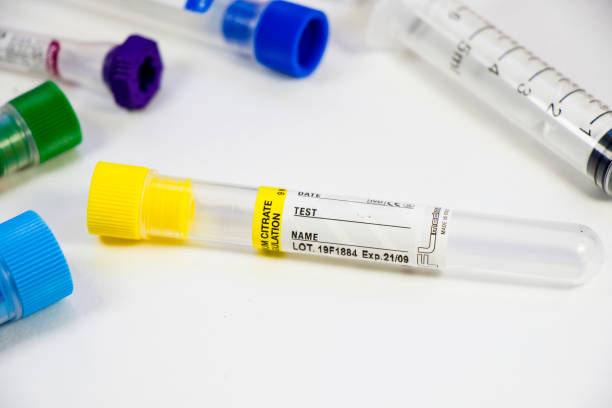 istock Blood test tubes on the white background, studio shoot. Blood test samples. Diagnosis and laboratory. 1256981969