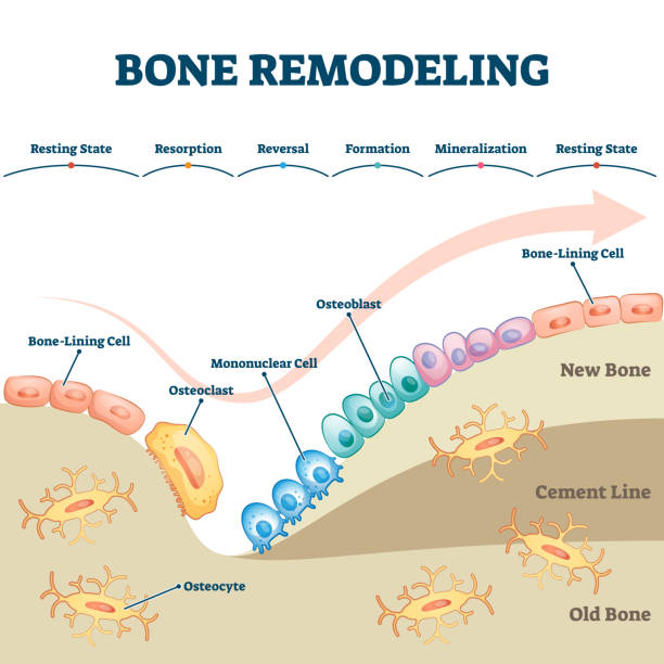 Bone Remodeling Process Educational Explanation With Labeled Structure  Scheme Stock Illustration - Download Image Now - iStock