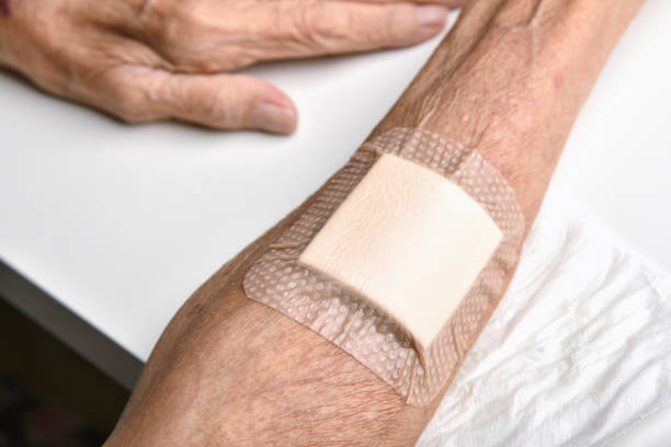 Wound bandage, Dressing arm wound with sterile plaster pad, Accidental wound care treatment in elder old man. stock photo