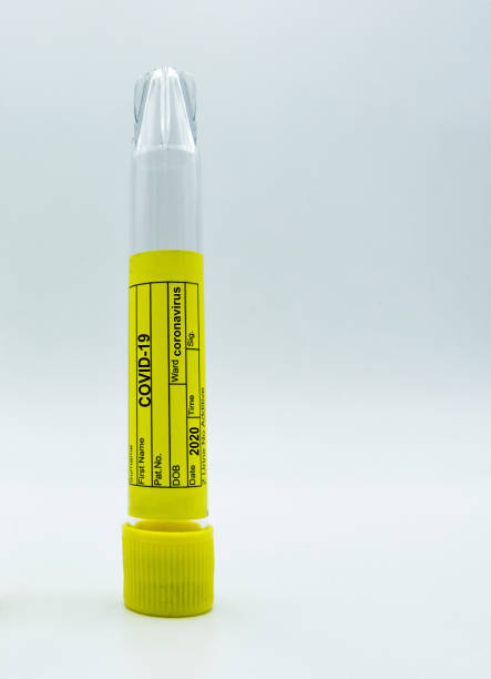 istock Test tube with covid-19 test label isolated on white background. Copyspace blank space 1257144520