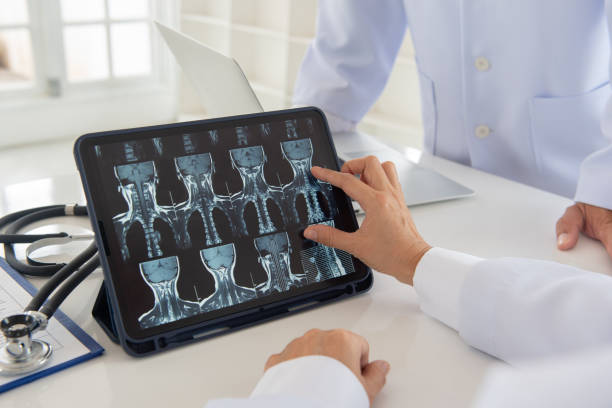 cervical vertebrae spine x-ray image Doctor check up cervical vertebrae spine x-ray image on digital tablet screen with medical team for consult. neck stock pictures, royalty-free photos & images