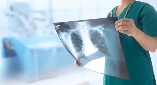 Photo of lung x-ray