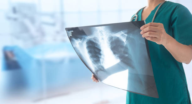 lung x-ray - research medical student doctor clinic imagens e fotografias de stock