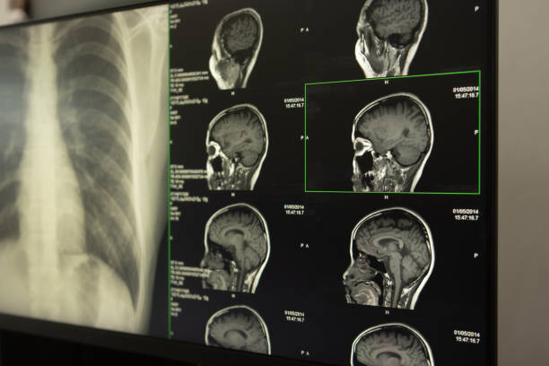 radiografia cerebrale - mri scanner cat scan x ray medical scan foto e immagini stock