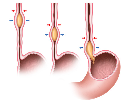 Peristalsis is a radially symmetrical contraction and relaxation of muscles that propagates in a wave down a tube