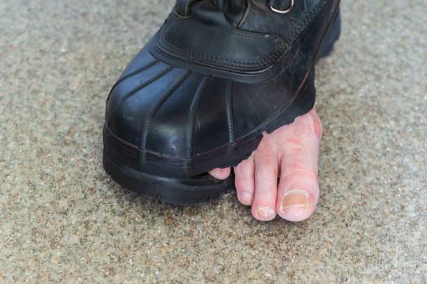 istock Toes peeking out of a ragged boot 1257168766