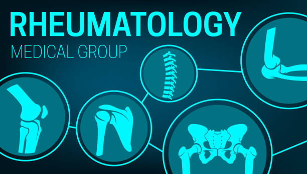 ilustrações, clipart, desenhos animados e ícones de medicina de reumatologia, articulações xray vetor pôster - rheumatic